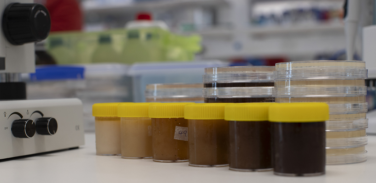 More than three-quarters of the honey samples stopped bacterial growth even when the honeys were diluted to 10% or less. University of Sydney