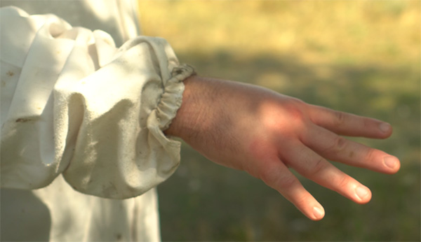 Stung Hand