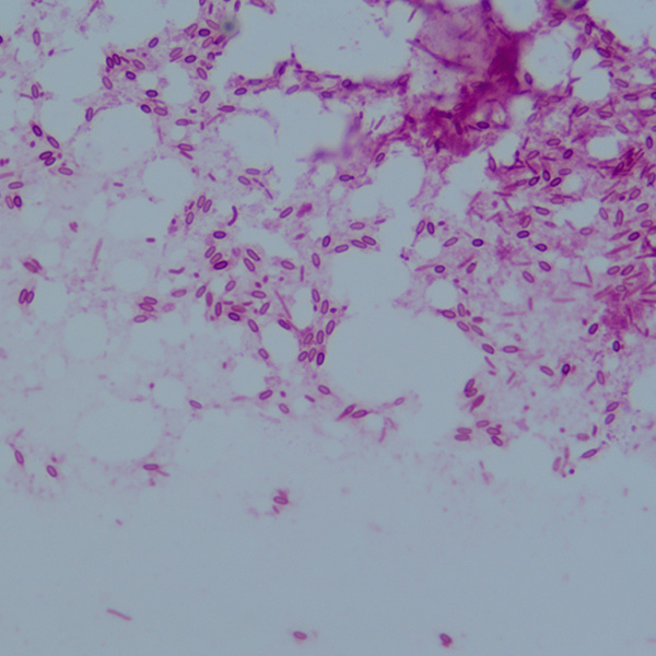 EFB through the microscope