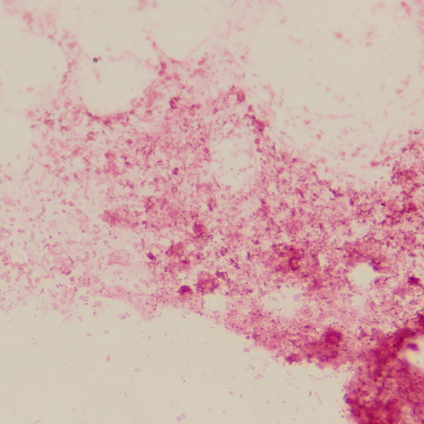 EFB through the microscope